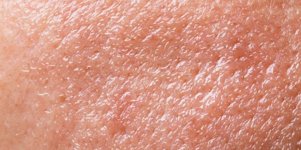 What products should I use for oily skin?