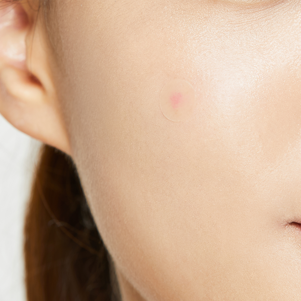 Acne Pimple Master